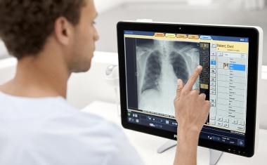 Philips stellt KI-gestützte Lösungen für die Röntgendiagnostik vor