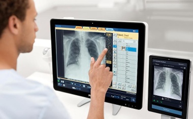 Röntgen mit KI-Unterstützung