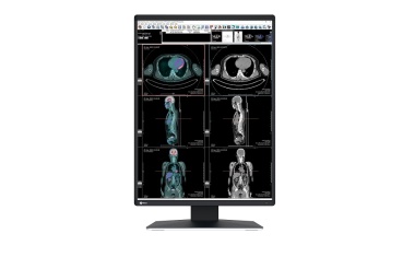 Neu für die radiologische Befundung