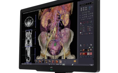 Sechs Megapixel für die diagnostische Radiologie
