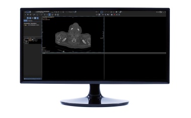Klinische Entscheidungsunterstützung direkt im PACS