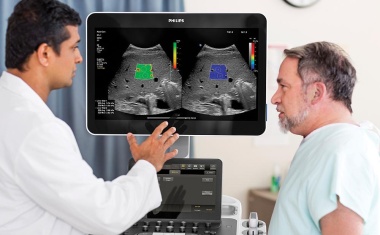 Tool für die Leberfettquantifizierung per Ultraschall