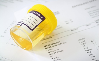 Optimierte Arbeitsabläufe in der Urinanalyse