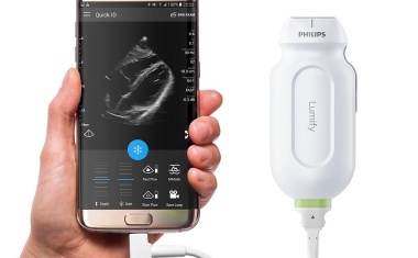 Mobiler appbasierter Ultraschall