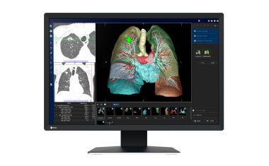 Neuer 2,3-Megapixel-Farbmonitor für die radiologische Befundung
