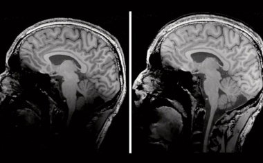 High-End-MRTs für Forschung und klinische Routine