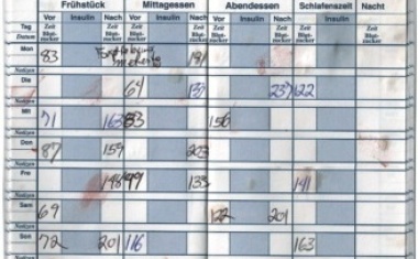 Diabetes Management mit der Pattern Analyse