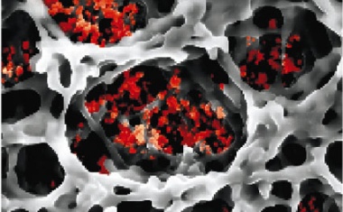 UKM-Chirurgie ist offiziell „Kompetenzzentrum für chirurgische Erkrankungen des Pankreas“