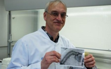 Grippewelle: UKM Virologen rechnen mit Höhepunkt an Karneval