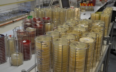 Hamburger Asklepios Kliniken: Screeningmaßnahmen gegen multiresistente Erreger