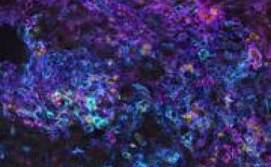 1,5 Millionen Euro für exzellente Infektionsforschung