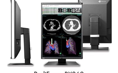 EIZO RadiForce RX360: Neuer 3-Megapixel-Farbmonitor für die Radiologie