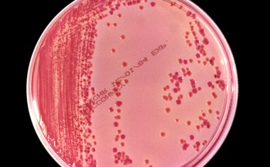 Bakterien mit extrem hoher Antibiotikaresistenz verbreiten sich über Krankenhäuser