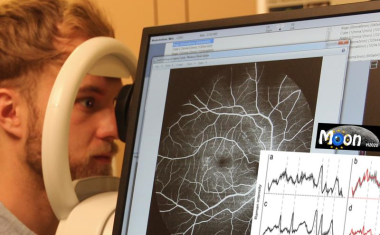 Augenscan macht Krankheiten frühzeitig sichtbar