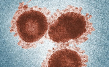 Erster Test für das neuartige Coronavirus