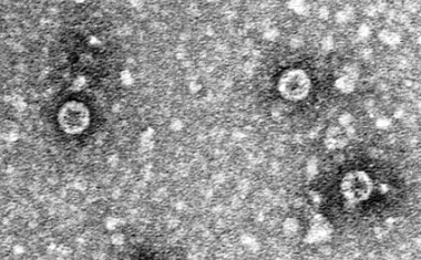 Prüfung von viruziden Waschverfahren auf Wirksamkeit in der Praxis