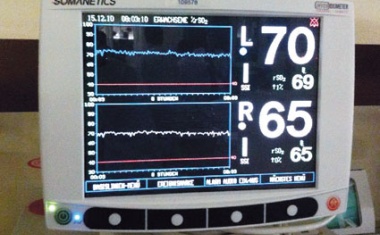 Bessere Vorhersage von Operationsrisiken
