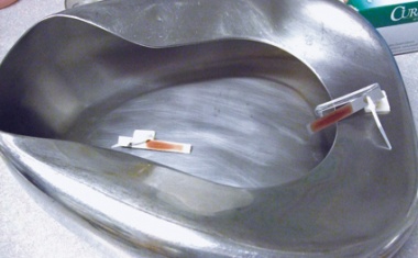 Steckbeckenspülern im Alltagsbetrieb: Die Einfachheit der Bedienung überzeugt