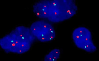 Biomarker zeigen längeres Überleben