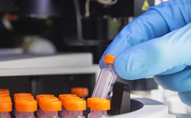 Intensivierter Kampf gegen Antibiotika-Resistenzen