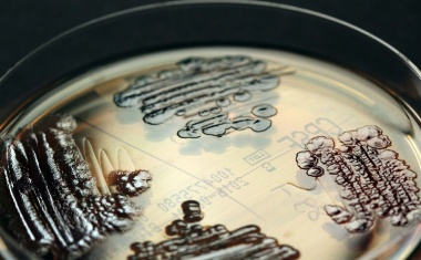 Wie kommen die multiresistenten Bakterien ins Krankenhaus?