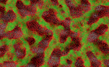 Bakterielle Biofilme detektieren und bekämpfen