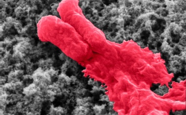 MEDICA/COMPAMED 2018: Keine Chance für Keime an Implantaten