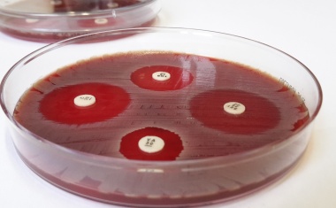 Antibiotikaresistenzen im Fokus der Forschung