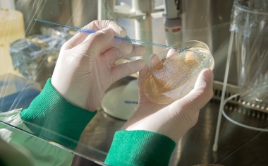 Studie zu Krankenhausinfektionen: Patienten bringen hochresistente ESBL-Keime mit in die Klinik