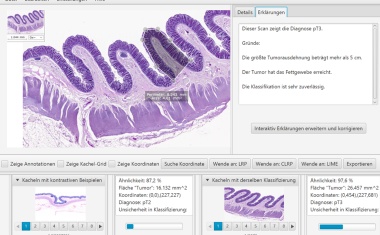 Wenn Mensch und Künstliche Intelligenz gemeinsam Diagnosen stellen
