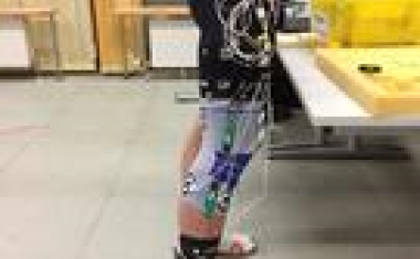 Entlastung durch intelligente Kniebandage