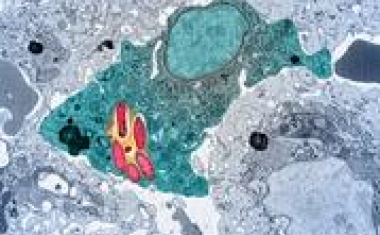 Magnesiummangel stoppt Wachstum von Krankheitserregern