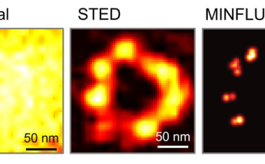 MINFLUX-Nanoskopie sieht Zellen molekular scharf