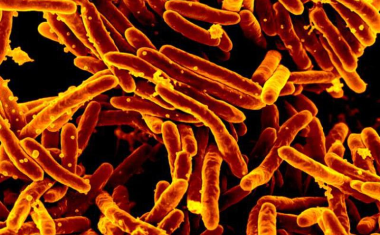 Wovon sich der Tuberkulose-Erreger ernährt