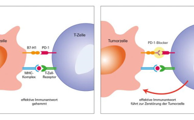 Wann wirkt eine Immun-Checkpoint-Blockade?