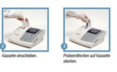 Plättchenfunktionstests auf dem Prüfstand