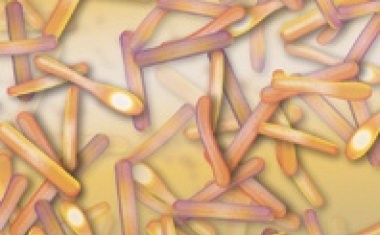 Clostridium-difficile-Diagnostik – altbekannt, aber immer aktuell