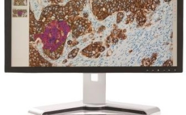 Die „Digitale Revolution“ in der Pathologie