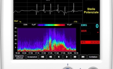 Monitoring der Narkosetiefe Narkosetiefe und des Delirs