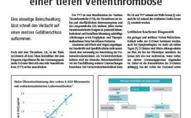 Zuverlässiger Ausschluss einer tiefen Venenthrombose