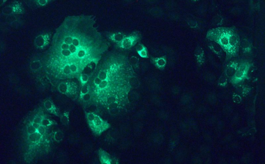 Neuer Ansatz für MERS-Therapie entdeckt