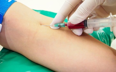 SARS-CoV-2-Antikörperrate unter einem Prozent