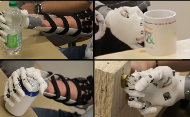 Dem Blick folgen – Die Handprothese verbessern