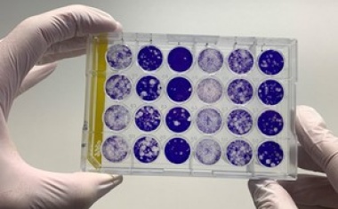 Coronavirus: Virologische Details zur Münchner Fallgruppe