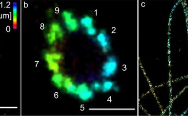Hürde der Mikroskopie überwunden