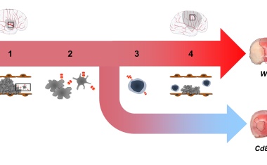 Durchbruch im Verständnis des Schlaganfalls