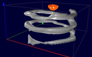Vielfarbige Bildgebung mit magnetischen Nanopartikeln