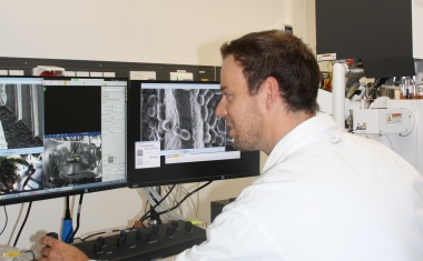 Infektionen verhindern mit Biomaterialien aus Spinnenseide