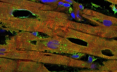 Neu entdeckter Mechanismus reguliert Herz-Dehnbarkeit