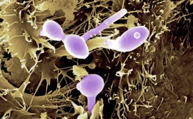 Antibiotika bringen Darmmikrobiom aus dem Gleichgewicht